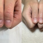 爪の縦線・横線が気になる！プロが教える改善アプローチとは