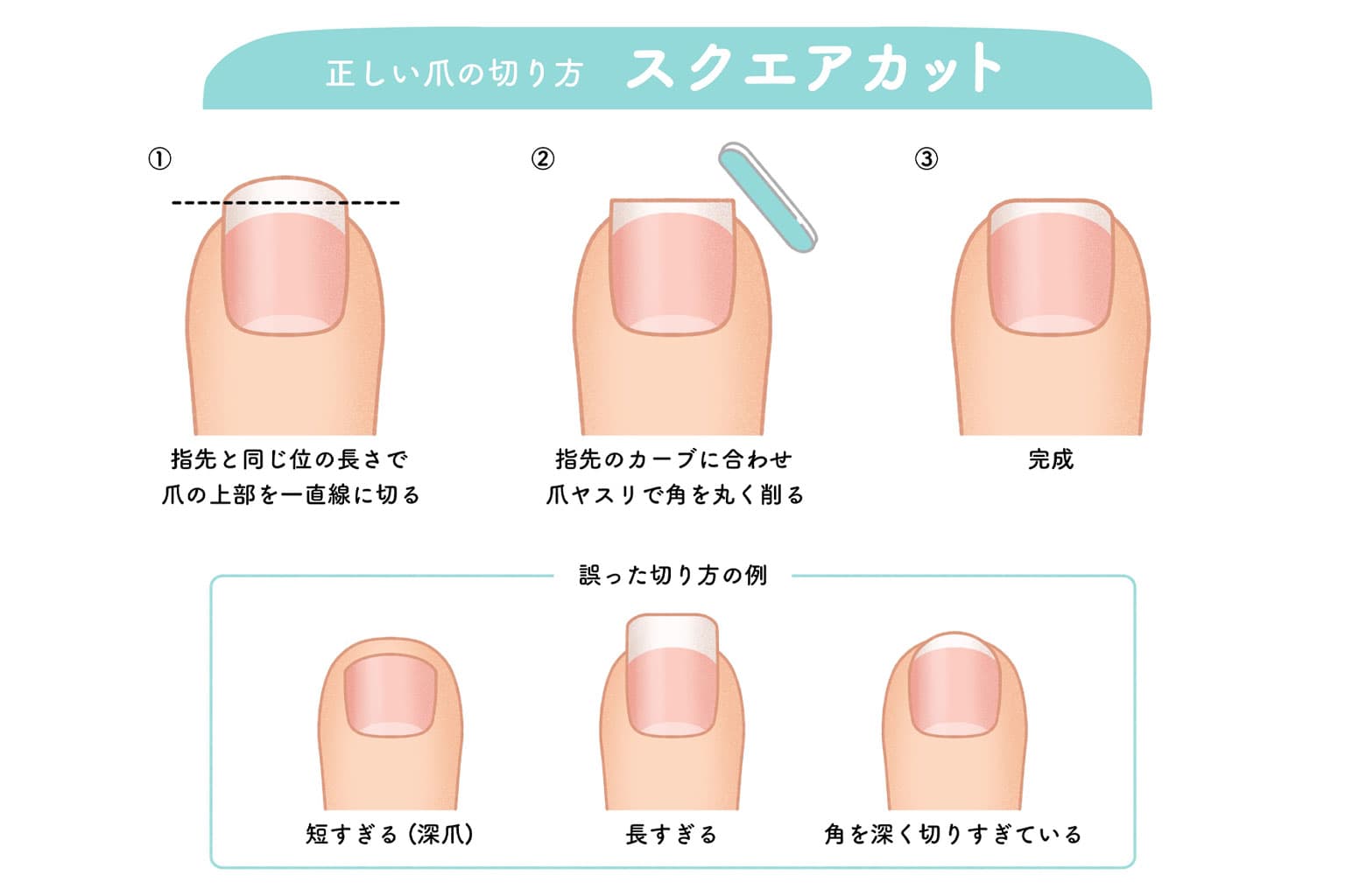 スクエアオフカットとラウンドカットの違いを示す図解。正しい切り方と間違った切り方による爪の成長への影響