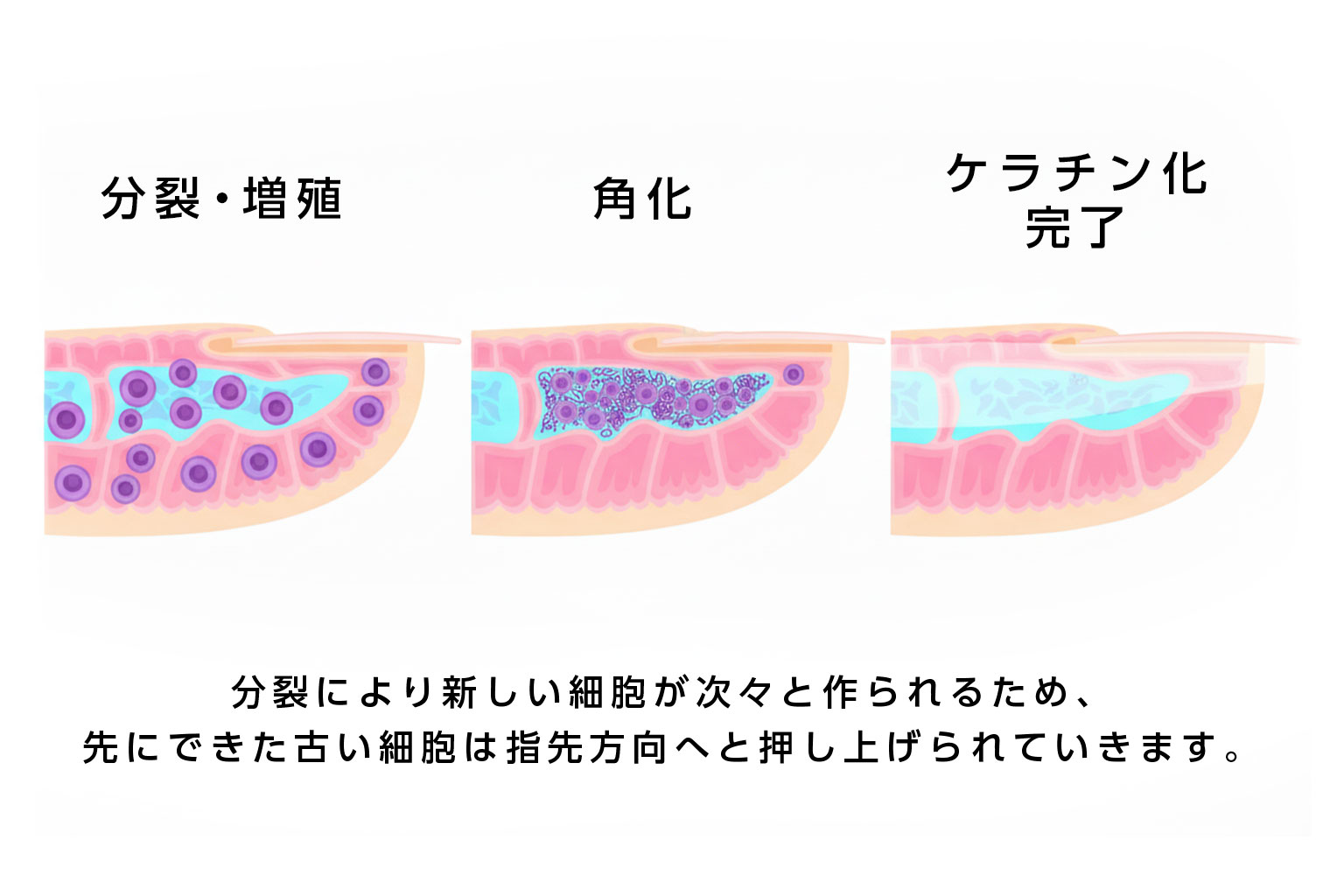 爪母での細胞分裂から爪甲形成までの成長プロセスを時系列で示した図解。ケラチン化の段階的変化と成長速度の違いを視覚的に表現した医学的イラスト