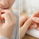 爪噛みと爪むしりの違いを示す図解。歯による咬行為と指による皮膚のいじりを対比